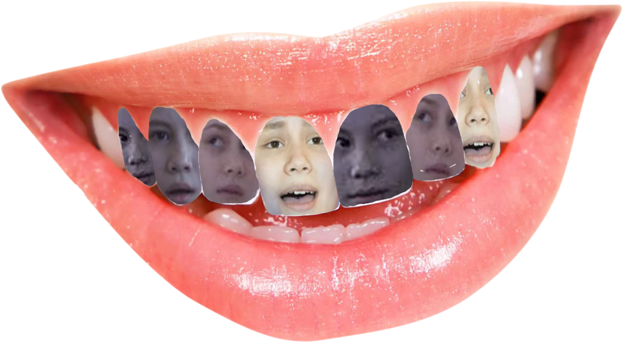 Download “buck Teethi'm So Sorry ” Human Tooth Full Size PNG Image