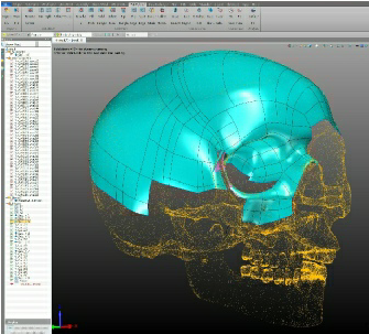 Reverse22 - Sphere (500x576), Png Download