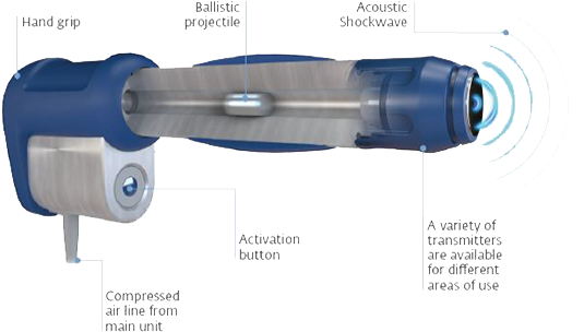 Is Broken As A Result Of Shock Wave Therapy And The - Does Shock Wave Therapy Work (600x398), Png Download