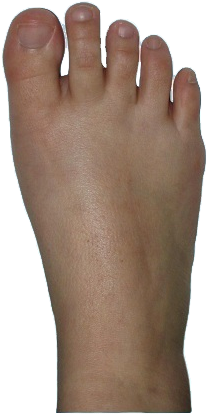 Top Of Foot Png (398x419), Png Download