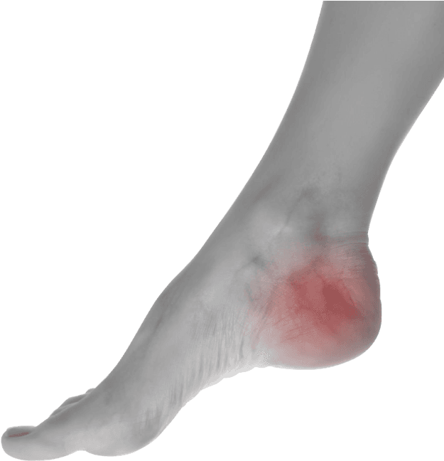 Choose The Most Trusted Podiatrist Doctor In The Area - Pain In Foot Png (640x707), Png Download