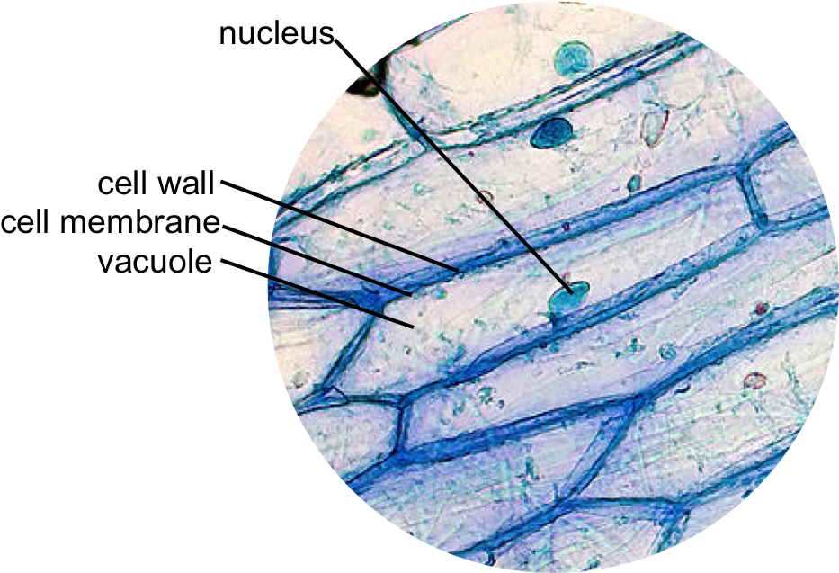 Epidermal Onion Cells Under A Microscope - Different Types Of Cells Under A Microscope (948x636), Png Download