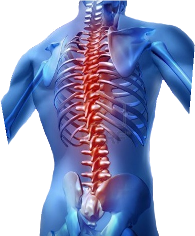 Spine Surgery (419x473), Png Download
