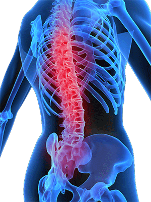 Spinal Injections Safety - Spinal Cord Movmebt (300x400), Png Download
