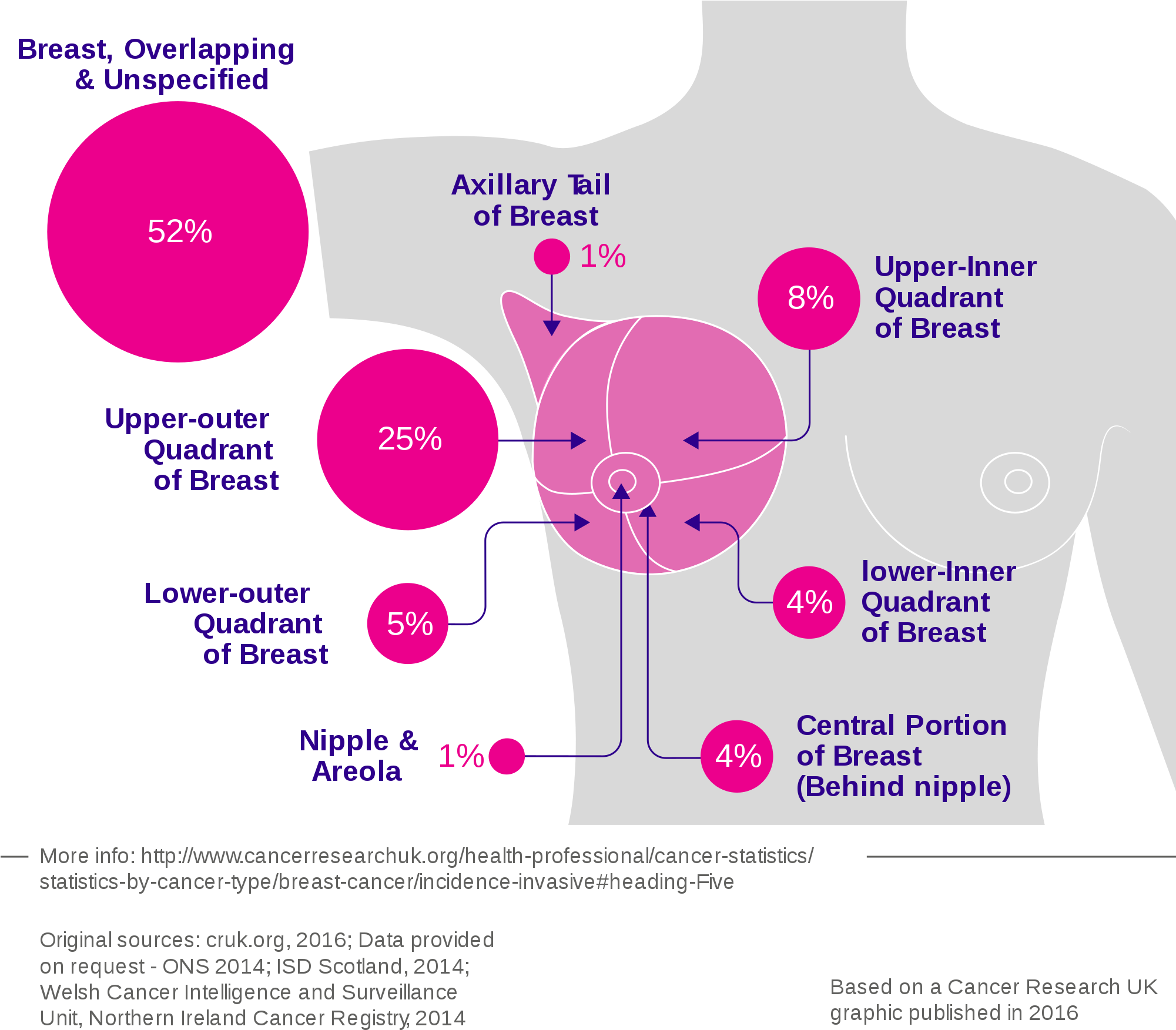 Open - Breast Cancer Overlapping Sites (2000x1806), Png Download