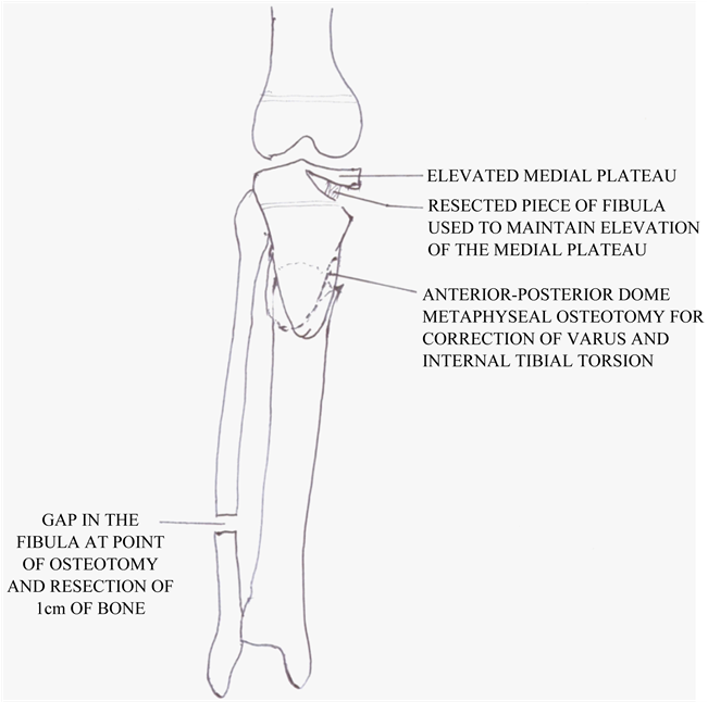 White Square Evidenced By Its Selection Of Styles, - Shelf (880x880), Png Download