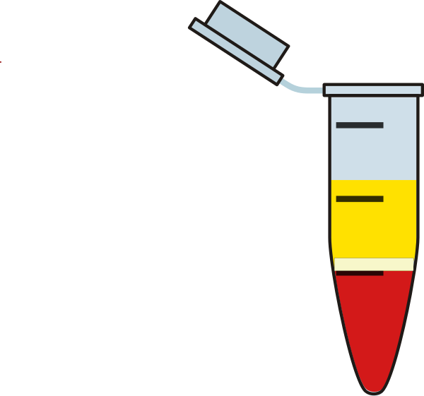 Small - Clip Art (600x561), Png Download