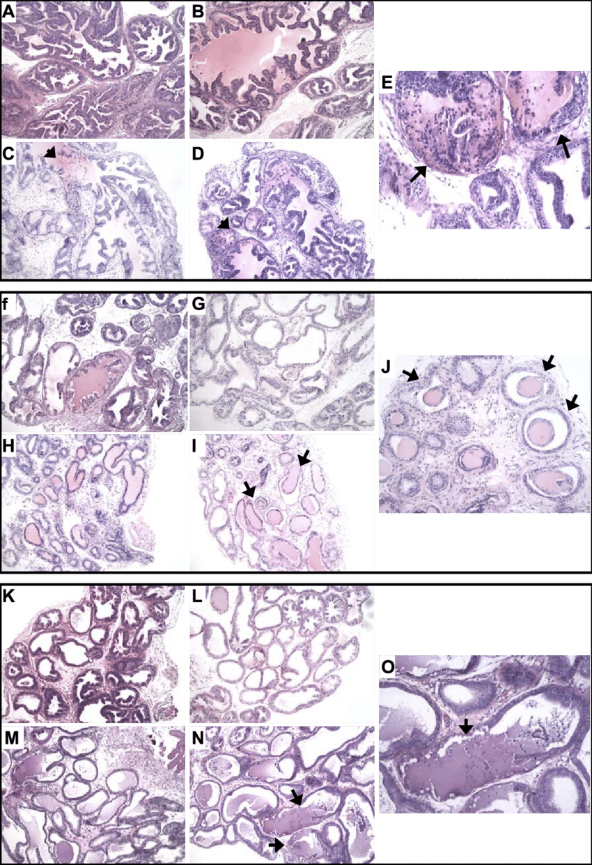Comparison Of Prostate Lobe Ap , Dlp (f J), And Vp - Dihydrotestosterone (850x1241), Png Download