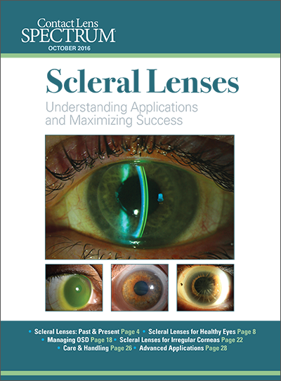 This Special Editorial Supplement Serves As An Introduction - Scleral Lens (400x543), Png Download
