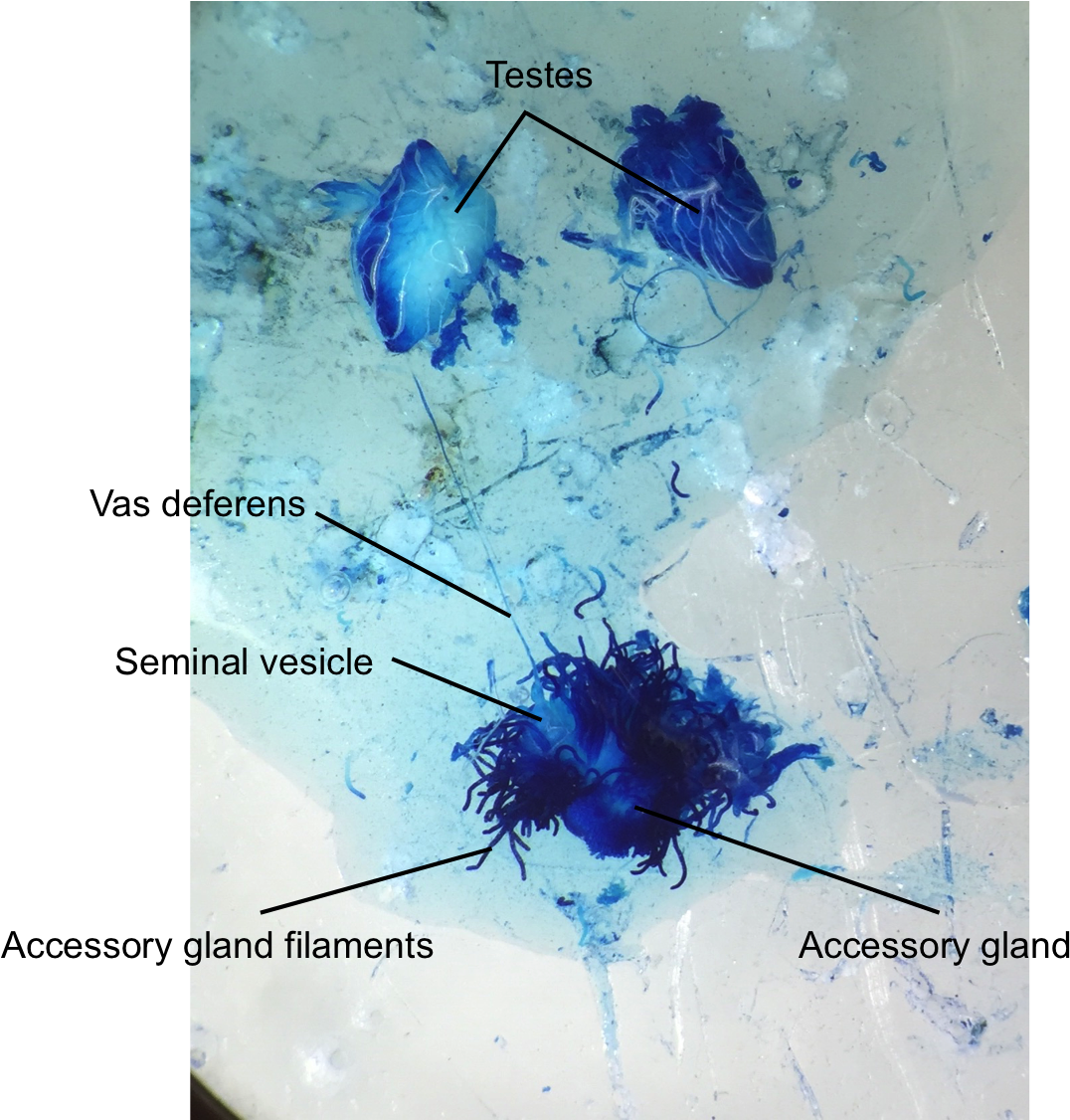 Female Cricket - - Male Reproductive System Of Locust (1113x1125), Png Download
