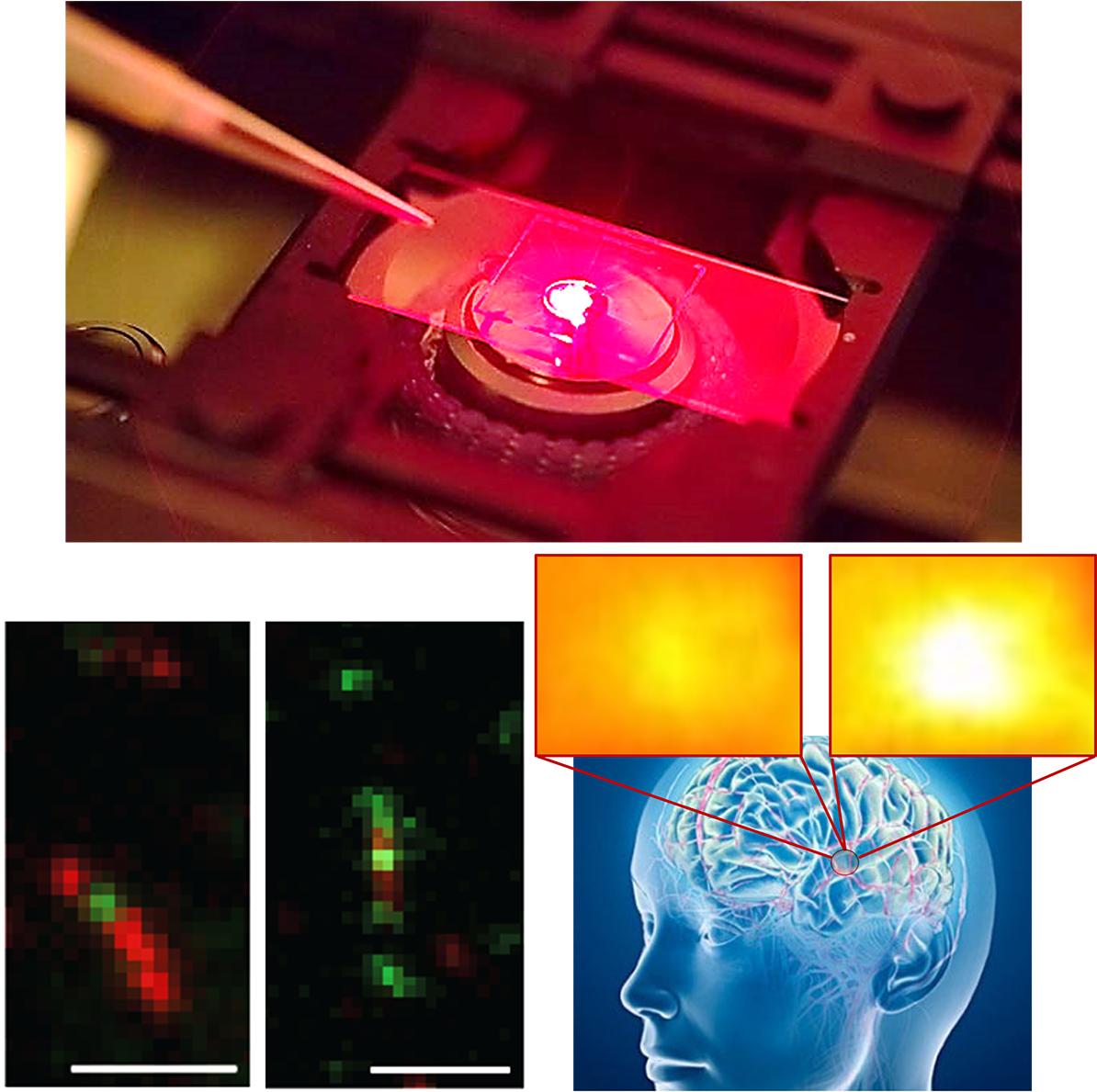 2018 Infrared Fluorescence Microscopy And Nanosensors - Nanosensor For Brain (1200x1188), Png Download