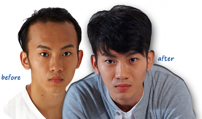 Aremy Hair Salon Is Very Customer Focus Both In Terms - Male Hair Loss Singapore (705x405), Png Download
