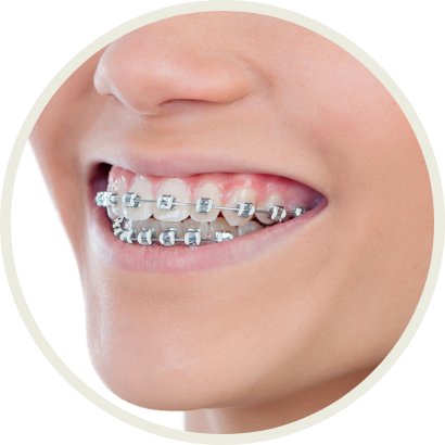 Color My Braces - Color Of Braces (410x410), Png Download