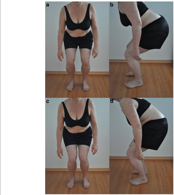 Test 2 «squat Up To 90°» Correct Performance - Point (850x766), Png Download