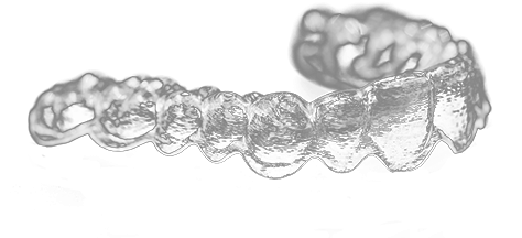 Advantages Of Phasing System - Zahnarztpraxis Andreas Porter (500x315), Png Download