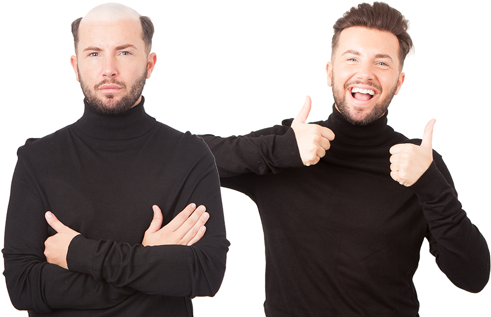Discover The Most Natural, Modern And Stylish Non-surgical - Non Surgical Hair Replacement Glasgow (1000x640), Png Download