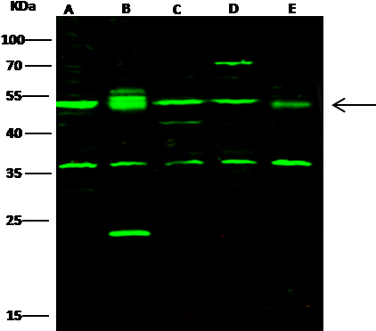 Mouse C-src Kinase / Csk Western Blot - Hsp60 (439x389), Png Download