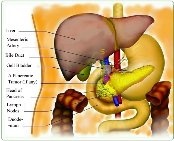 Location Of The Pancreatic Tumor - Pancreas In French (902x482), Png Download