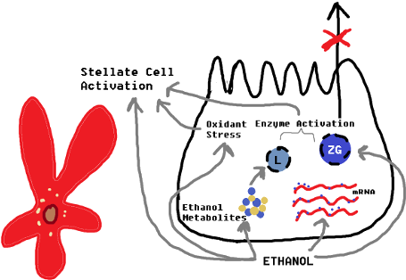 Hypothetical Development Of Alcoholic Pancreatitis - Alcohol And Pancreatitis (480x335), Png Download