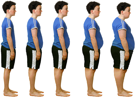 Why Do Some People Get Fat Even When They Eat Relatively - Teenage Puppy Fat (500x373), Png Download