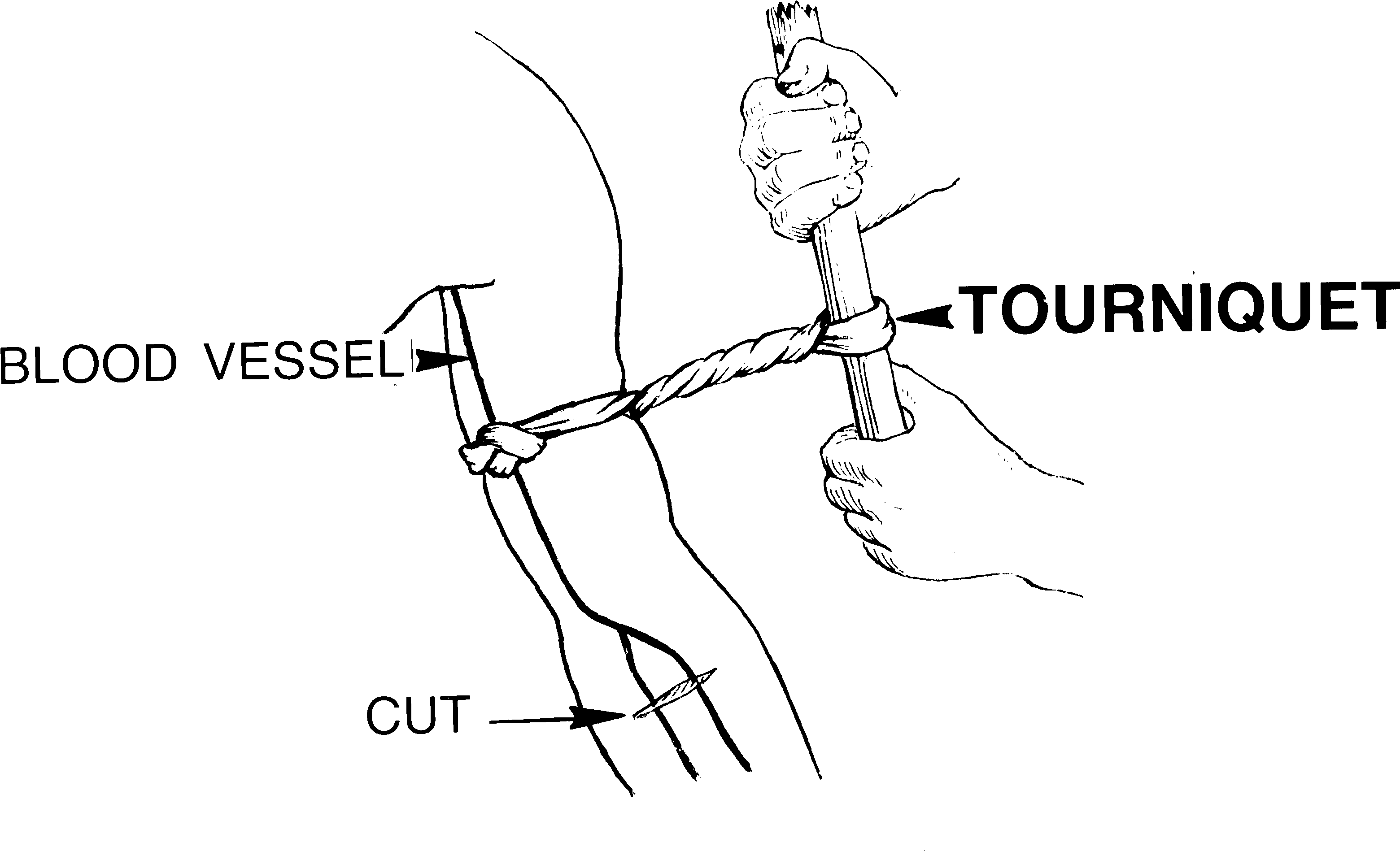 Tourniquet (3150x1960), Png Download