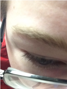 Bushy Eyebrows - Close-up (400x300), Png Download