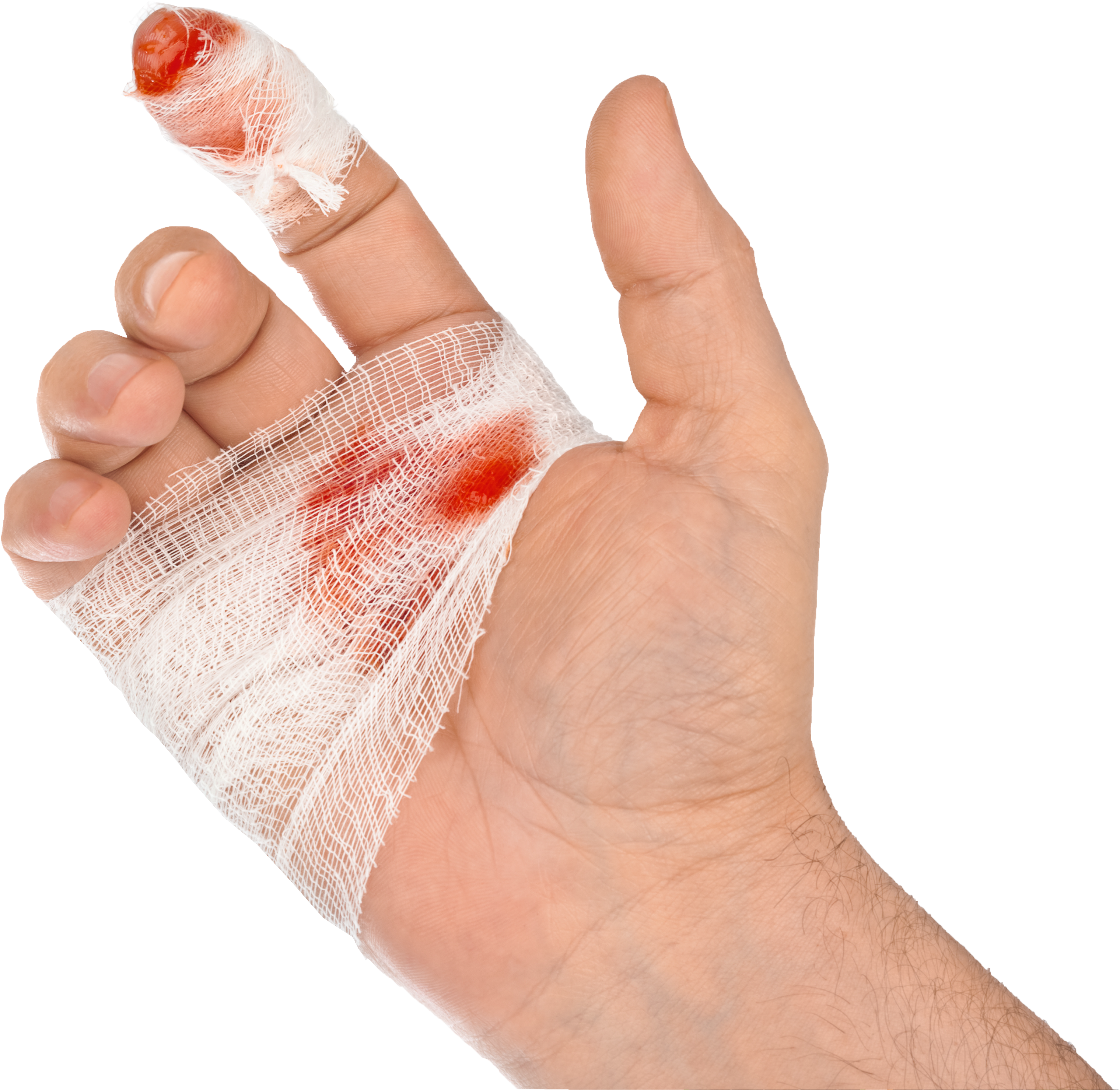 Steel Doctor Blade Injury Cut - Hand Blood (4476x3577), Png Download