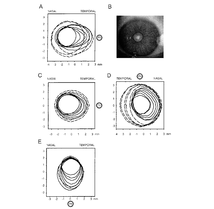 Pupil Dilation Following Focal Drug Application - Circle (850x828), Png Download
