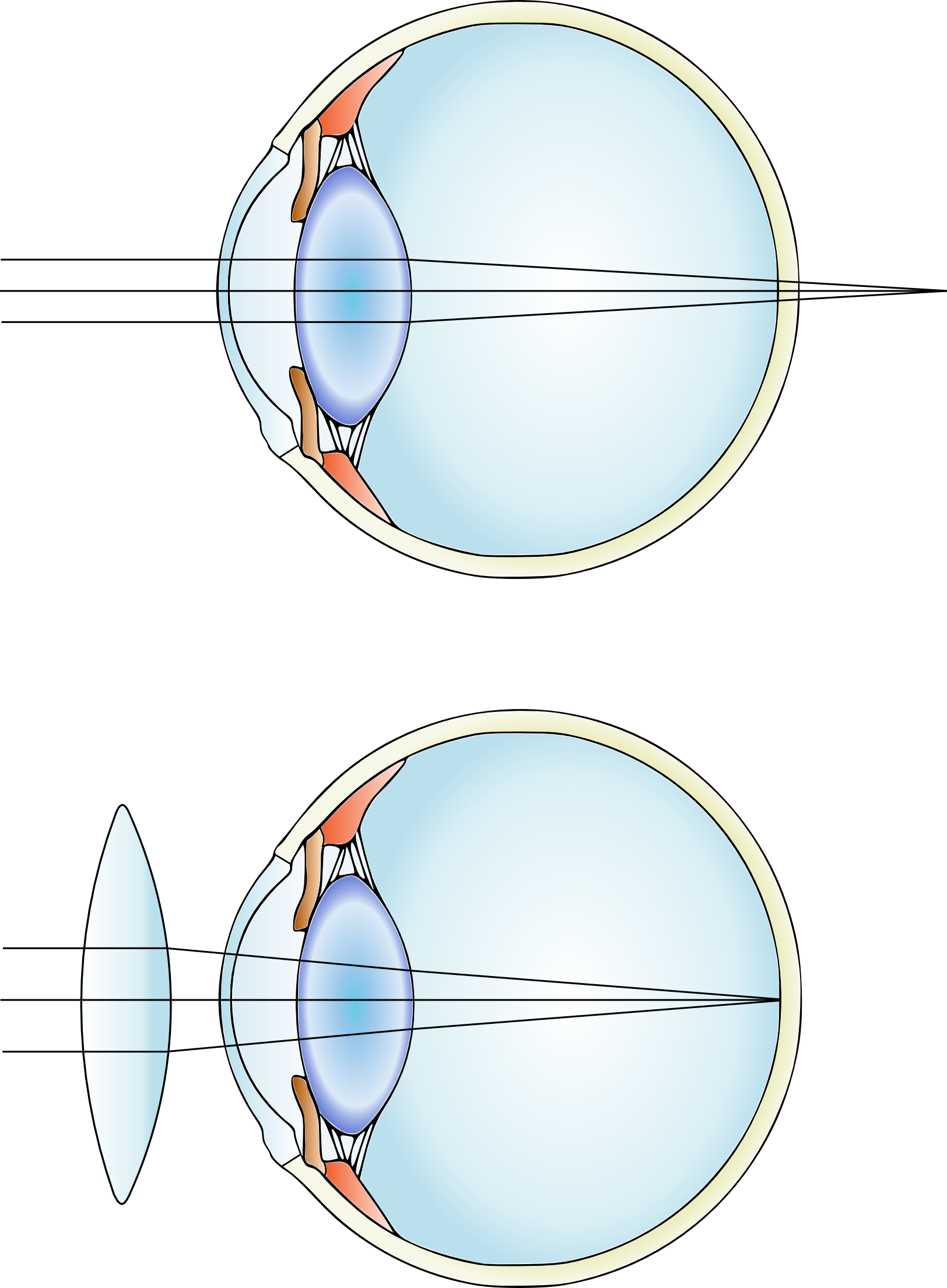 Far-sightedness (1624x2209), Png Download