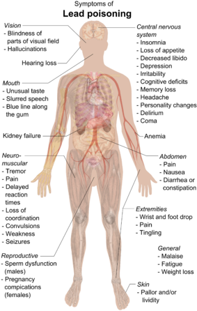 Who Discovered The Nervous System Best Of Lead Poisoning - Lead Poisoning Symptoms (290x450), Png Download