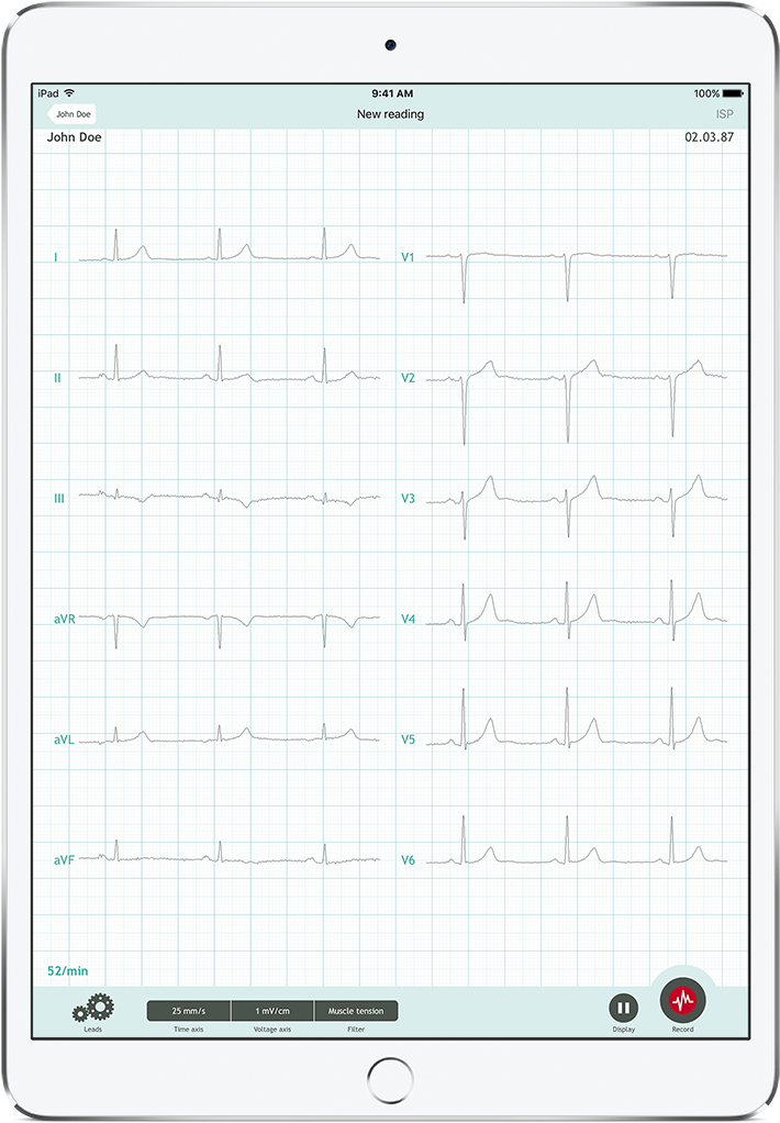 Cardiosecur Pro 12 Leads - Paper (911x1224), Png Download