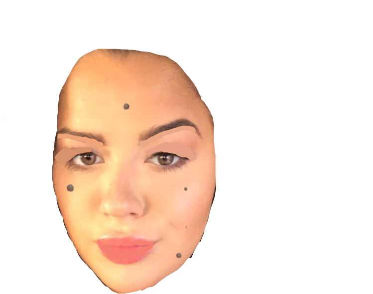 Tessawithpimple Tessa Tessabrooks Pimple Acne - Acne (749x592), Png Download