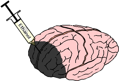 Symbolic Effect Of Brain Damaged By Too Much Alcohol - Brain And Alcohol Png (582x374), Png Download