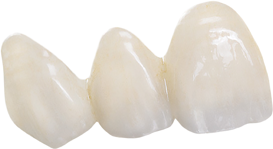 Bruxzir Anterior Teeth - Brassiere (600x329), Png Download