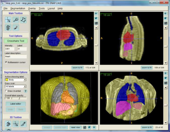 The Rendered Anatomy Are The Lungs , Heart (red), Liver - Rendering (850x461), Png Download