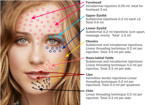 Facial Rejuvenation/ Facial Scarring - Facial Rejuvenation (499x353), Png Download