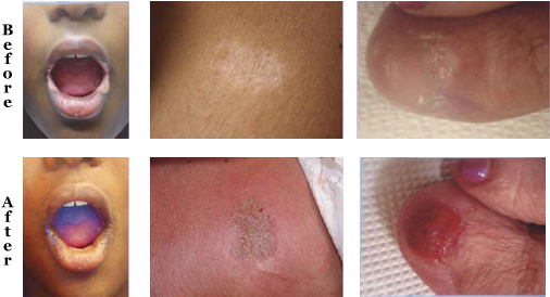 Fees Based At Hourly Rate And Will Be Determined At - Scar Blending (505x286), Png Download