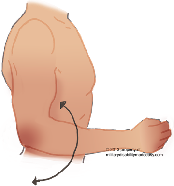 Upper Nerve 15 - Illustration (360x385), Png Download
