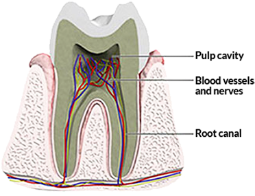 A Root Canal Is A Hollow Area Inside Your Tooth That - Fogfájás Gyógyszer (400x328), Png Download