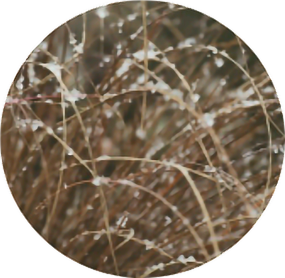 Snow Grass Brown Circle Aesthetic Aestheticcircle - Instagram (568x554), Png Download