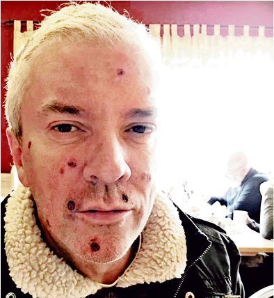 Telly Star Justin Ryan Reveals Shock Cancer Scare After - Colin Justin 60 Minute Makeover (636x427), Png Download