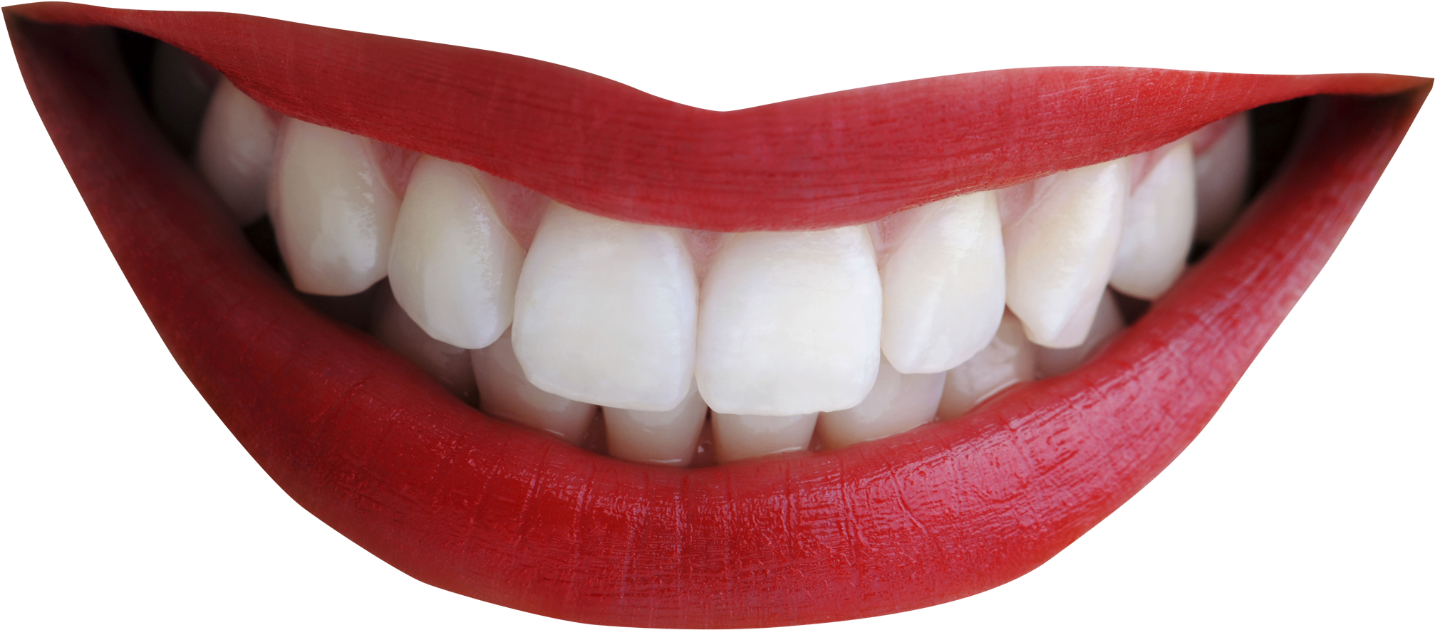 Smiling Lips Png - Cara Alami Buat Gigi Tidak Maju (2163x1369), Png Download