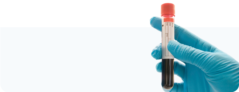 My Pet Is Having A Blood Test - Blood Sample Png (777x340), Png Download
