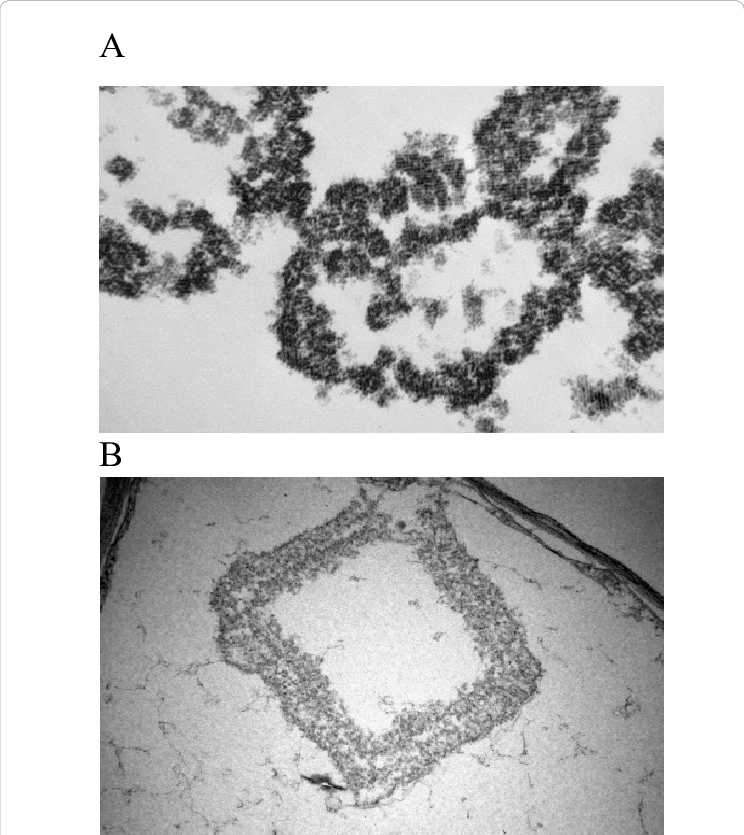 A) Cmv Viral Nanoparticles Appears In Geometric Rows - Crystal (744x835), Png Download