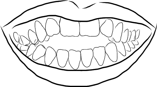 Invisalign® - Outline Of An Open Mouth Showing Teeth (582x321), Png Download