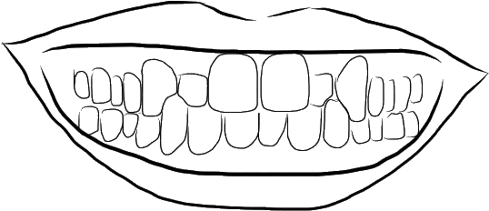 Crossbite - Line Art (582x321), Png Download