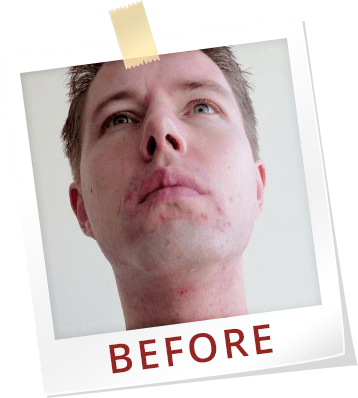 Paul Jaminet Ph - Logan Paul With Pimples (358x398), Png Download