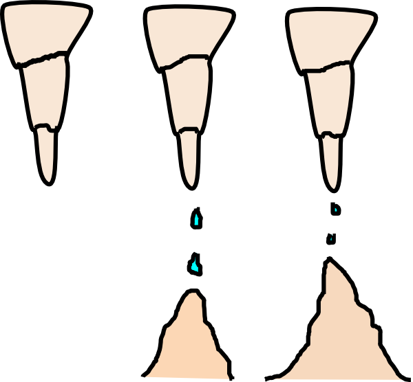 Small - Stalactites And Stalagmites Clipart (600x556), Png Download