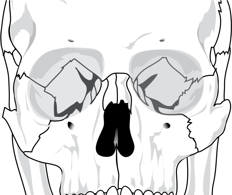 Human Skull Diagram (800x648), Png Download