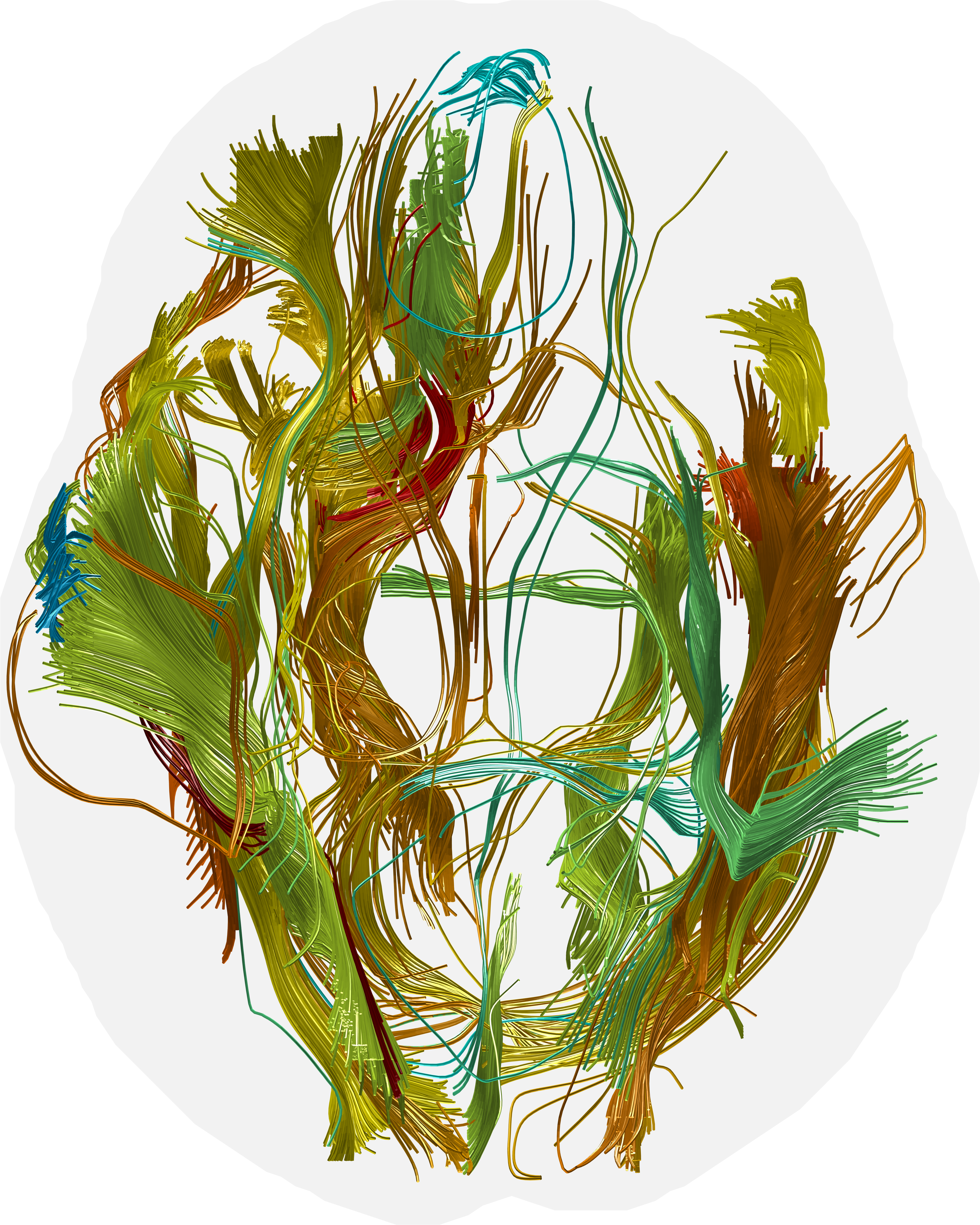 Individually Control The Tract Bundle Colors To Reflect - Illustration (4202x5252), Png Download